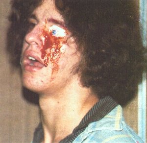 Yearbook bloody eye.jpg (76193 bytes)